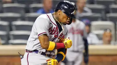 Precaución en Atlanta: Ronald Acuña sigue fuera de la alineación Precaución en Atlanta: Ronald Acuña sigue fuera de la alineación