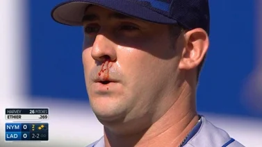 Matt Harvey podría enfrentarse a una suspensión por distribución de drogas