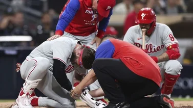 MLB: Bryce Harper podría perder el resto de la temporada, luego de recibir un pelotazo