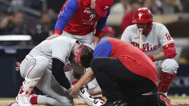 MLB: Bryce Harper podría perder el resto de la temporada, luego de recibir un pelotazo MLB: Bryce Harper podría perder el resto de la temporada, luego de recibir un pelotazo