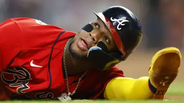 MLB: Ronald Acuña Jr. sin daño, ni fractura MLB: Ronald Acuña Jr. sin daño, ni fractura
