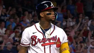 MLB: Ronald Acuña Jr: "Estoy volviendo a la normalidad" MLB: Ronald Acuña Jr: "Estoy volviendo a la normalidad"