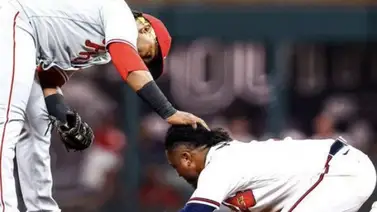 MLB: Ozzie Albies sufre lesión y provoca un duro golpe para Bravos (+VIDEO) MLB: Ozzie Albies sufre lesión y provoca un duro golpe para Bravos (+VIDEO)
