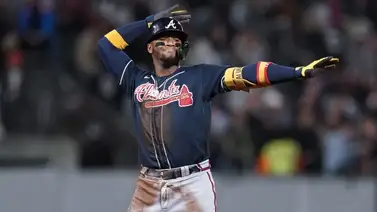 MLB: Ronald Acuña Jr. regresa a los jardines de los Bravos MLB: Ronald Acuña Jr. regresa a los jardines de los Bravos
