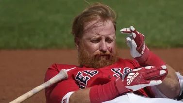 MLB: Así le queda la cara a Justin Turner luego de recibir pelotazo (+FOTO)