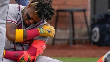 MLB: Kelvim Escobar revela que pelotazo a Ronald Acuña Jr. fue un mensaje de los Mets