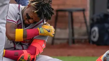 MLB: Kelvim Escobar revela que pelotazo a Ronald Acuña Jr. fue un mensaje de los Mets MLB: Kelvim Escobar revela que pelotazo a Ronald Acuña Jr. fue un mensaje de los Mets