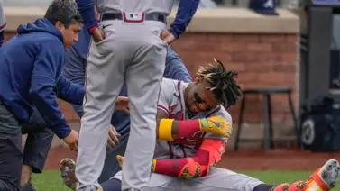 MLB: Esto dice Ronald Acuña Jr. sobre el pelotazo que recibió (+VIDEO) MLB: Esto dice Ronald Acuña Jr. sobre el pelotazo que recibió (+VIDEO)