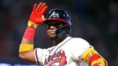 MLB: Ronald Acuña sobre su brillante 2023: "Nunca me pongo metas. Estoy enfocado en mantenerme saludable" MLB: Ronald Acuña sobre su brillante 2023: "Nunca me pongo metas. Estoy enfocado en mantenerme saludable"