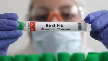 ¡Alerta en México! Muere un hombre por gripe aviar AH5N2 en laboratorio ¡Alerta en México! Muere un hombre por gripe aviar AH5N2 en laboratorio