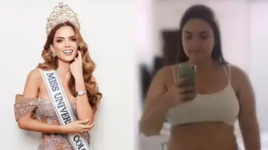 Daniela Toloza, Miss Colombia 2024 habla de la verdad detrás de su cirugía bariátrica Daniela Toloza, Miss Colombia 2024 habla de la verdad detrás de su cirugía bariátrica