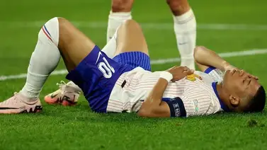 Eurocopa 2024: La razón por la cual el Real Madrid permitirá que Mbappé juegue con la nariz rota Eurocopa 2024: La razón por la cual el Real Madrid permitirá que Mbappé juegue con la nariz rota