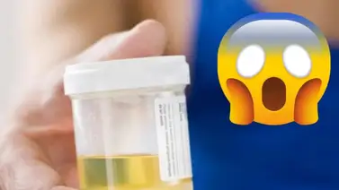 Este actor admite untar orina en su cara para mantenerse joven Este actor admite untar orina en su cara para mantenerse joven