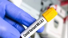 Recomendaciones para evitar contagios por el COVID-19