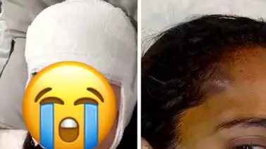 Reconocida actriz terminó en el hospital con golpes por fuerte caída Reconocida actriz terminó en el hospital con golpes por fuerte caída