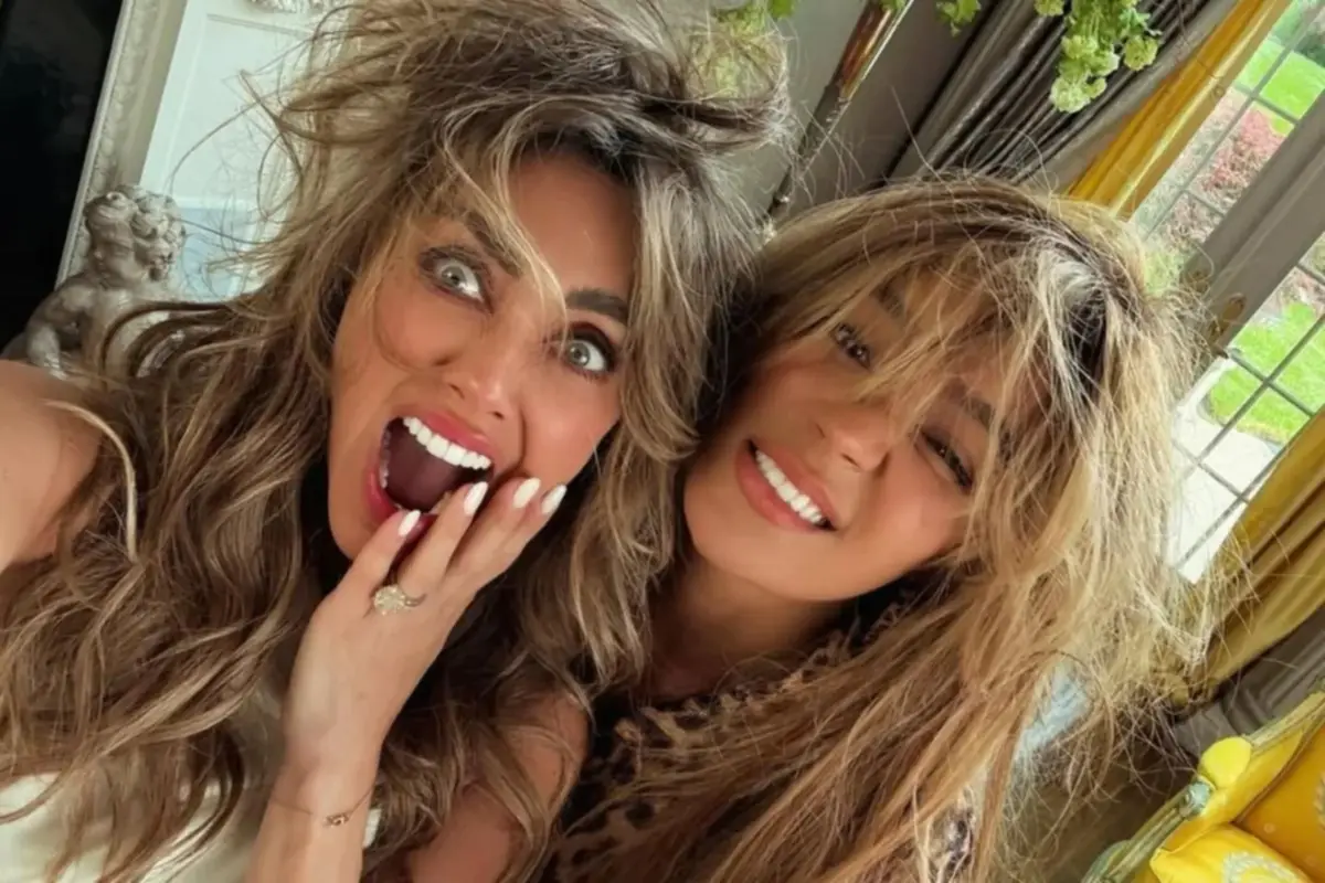 Anahí sufre lesiones luego de “pelear” con Karol G (+Foto)