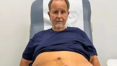 Salud de Raúl de Molina en peligro: "Estaba botando sangre por todos lados" Salud de Raúl de Molina en peligro: "Estaba botando sangre por todos lados"