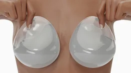 Detectan raro linfoma asociado a implantes mamarios