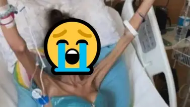 Muere influencer a sus 30 años tras cruel batalla contra la anorexia Muere influencer a sus 30 años tras cruel batalla contra la anorexia