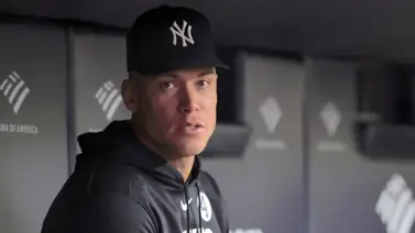 MLB: Aaron Judge se perderá un tiempo considerable MLB: Aaron Judge se perderá un tiempo considerable