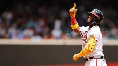 MLB: Este sería el "éxito" ideal para Ronald Acuña Jr. en el juego de Estrellas de las Grandes Ligas (+declaraciones) MLB: Este sería el "éxito" ideal para Ronald Acuña Jr. en el juego de Estrellas de las Grandes Ligas (+declaraciones)