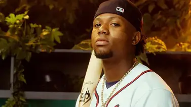 MLB: Ronald Acuña Jr. buscará acabar con el maleficio ante los Medias Blancas MLB: Ronald Acuña Jr. buscará acabar con el maleficio ante los Medias Blancas