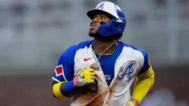MLB: Ronald Acuña Jr. se une a esta histórica lista de venezolanos en Grandes Ligas MLB: Ronald Acuña Jr. se une a esta histórica lista de venezolanos en Grandes Ligas