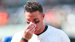 MLB: !Aterrador¡ James McCann recibe pelotazo en la cara y sigue jugando