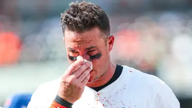 MLB: !Aterrador¡ James McCann recibe pelotazo en la cara y sigue jugando