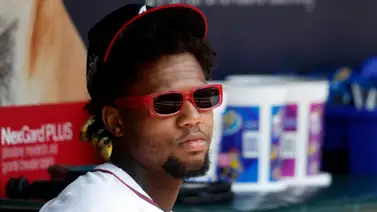 MLB: ¿Se pierde el Juego de Estrellas? Esto dice Ronald Acuña Jr. sobre su lesión MLB: ¿Se pierde el Juego de Estrellas? Esto dice Ronald Acuña Jr. sobre su lesión