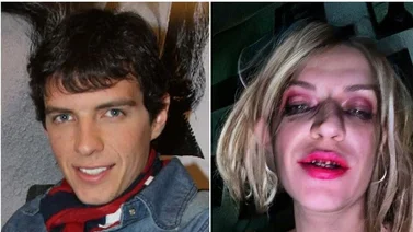 Hija de Camilo Sesto aparece en redes con gran herida en la cara