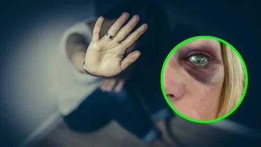 Exmodelo de Play Boy acusa a su ex de golpearla brutalmente