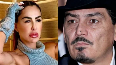 Ex de Ninel Conde arremete en su contra y le recomienda “vivir sin botox” 