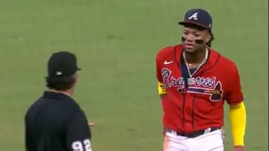 MLB: Vea como Ronald Acuña Jr. es obligado a cambiar de guante ante los Gigantes (+Video) MLB: Vea como Ronald Acuña Jr. es obligado a cambiar de guante ante los Gigantes (+Video)
