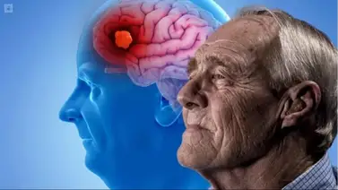 El Alzheimer se puede curar según este más reciente estudio El Alzheimer se puede curar según este más reciente estudio