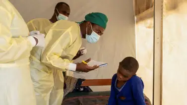 viruela del mono viruela del mono