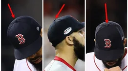 MLB: ¿Por qué las gorras de beisbol tienen un botón en la parte superior?