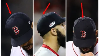 MLB: ¿Por qué las gorras de beisbol tienen un botón en la parte superior?
