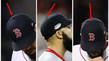 MLB: ¿Por qué las gorras de beisbol tienen un botón en la parte superior? MLB: ¿Por qué las gorras de beisbol tienen un botón en la parte superior?