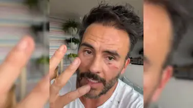 El complicado momento de salud que se encuentra atravesando el actor Juan Pablo Raba El complicado momento de salud que se encuentra atravesando el actor Juan Pablo Raba