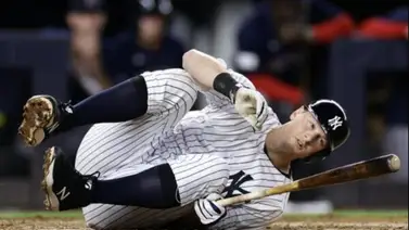 MLB: Yankees de Nueva York puede perder a este jugador por pelotazo (+Detalles) MLB: Yankees de Nueva York puede perder a este jugador por pelotazo (+Detalles)