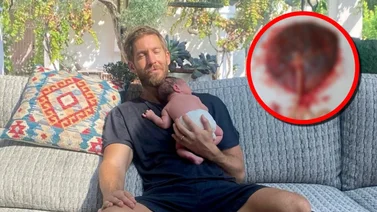 Esposa de Calvin Harris se come la placenta para obtener beneficios 