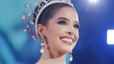 Andrea Rubio en riesgo por picadura de medusas ¡Qué susto! Andrea Rubio en riesgo por picadura de medusas ¡Qué susto!