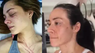 Le recuerdan a Osmariel Villalobos la brutal pelea con Diosa Canales: Así reaccionó Le recuerdan a Osmariel Villalobos la brutal pelea con Diosa Canales: Así reaccionó