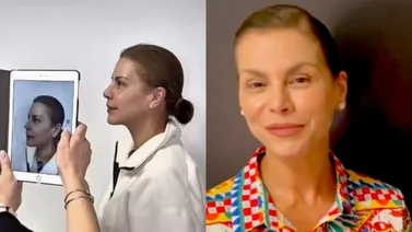 Olga Tañón se sometió a tratamiento rejuvenecedor a sus 58 años