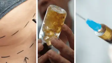 Comediante venezolano revela dura lucha contra los biopolímeros: "Duele muchísimo" Comediante venezolano revela dura lucha contra los biopolímeros: "Duele muchísimo"