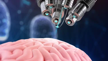 ¡Susto! Esta empresa comenzará sus ensayos clínicos para hacer implantes en cerebros humanos