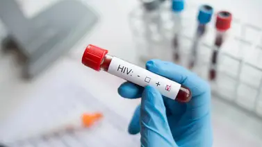 ¡Revolución médica! Paciente se cura del VIH con trasplante de células madre
