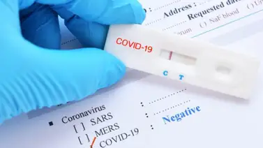 EEUU | Gobierno ofrecerá pruebas de Covid-19 gratis a finales de septiembre EEUU | Gobierno ofrecerá pruebas de Covid-19 gratis a finales de septiembre