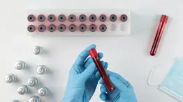 El descubrimiento sobre las plaquetas que puede revolucionar la lucha contra el cáncer: hallazgo de la Universidad de Oxford